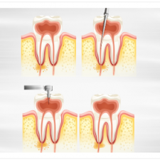 Dental-Services-Text-Image-15